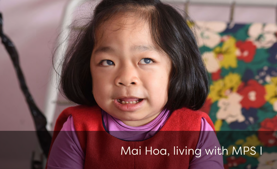 A child with Mucopolysaccharidosis (MPS) type I